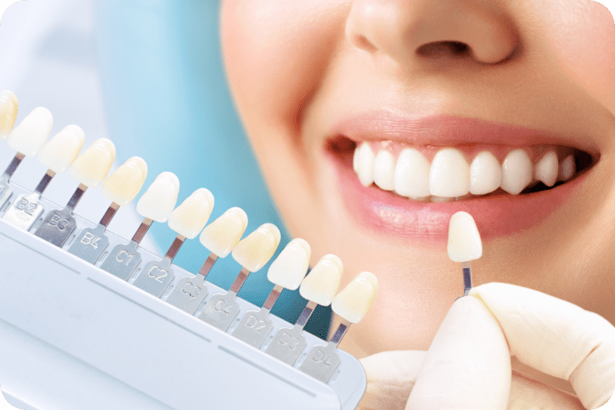 歯のカラーサンプルの画像